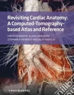 Novità Revisiting Cardiac AnatomyA Computed-tomography-based Atlas and Reference