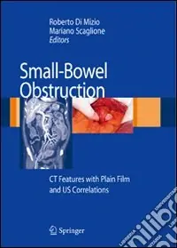 Small-bowel obstruction CT features with plain film and US correlations Ordina Subito