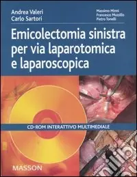 Prezzo Scontato Emicolectomia sinistra per via laparotomica e laparoscopica. CD-ROM